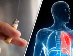 The link between smoking and lung cancer – 2baconil