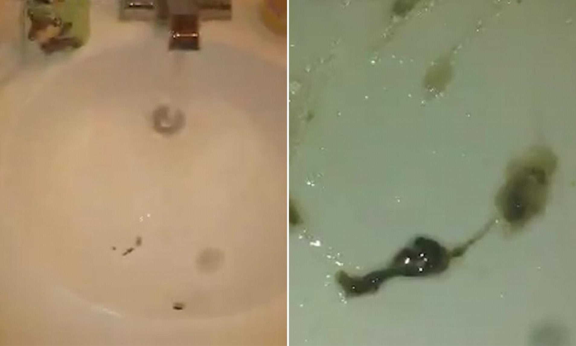 LiveLeak footage shows ex-smoker coughing up black tar from his lungs