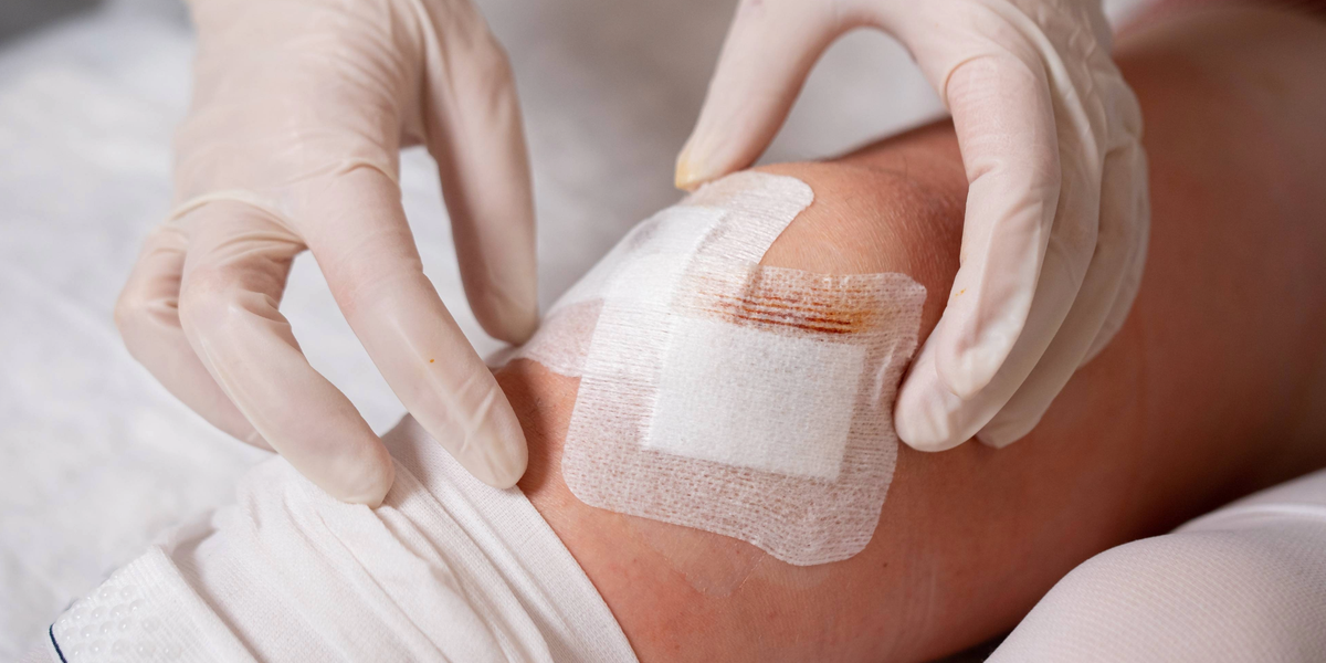Overview of Different Wound Dressings